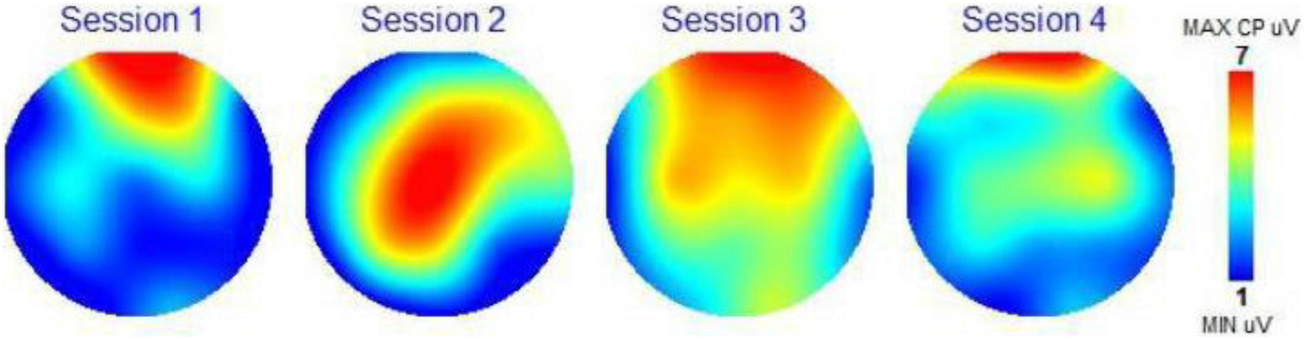 EEG-Messung zur Untersuchung der Auswirkungen von binauralen Beats auf die interhemisphärische Kohärenz im Alpha-Band.