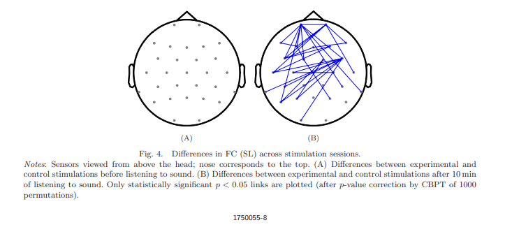 EEG-Messung zur Untersuchung der Auswirkungen von binauralen Beats auf die interhemisphärische Kohärenz im Alpha-Band.