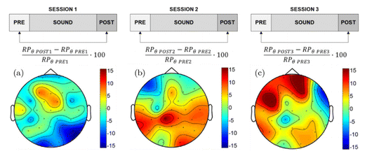 EEG-Messung zur Untersuchung der Auswirkungen von binauralen Beats auf die interhemisphärische Kohärenz im Alpha-Band.