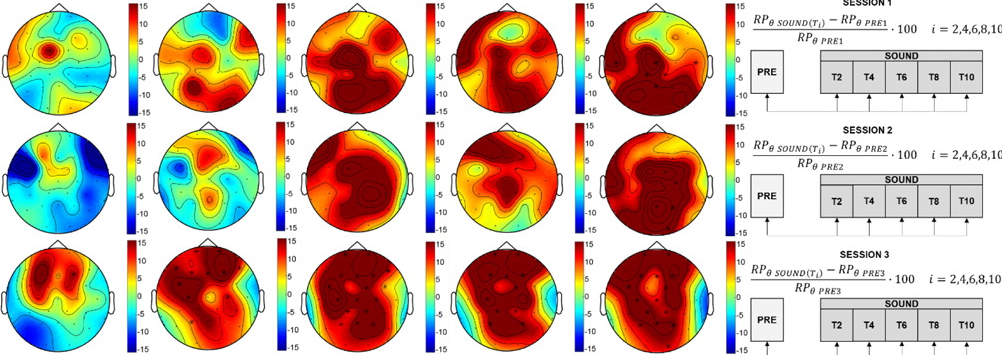 EEG-Messung zur Untersuchung der Auswirkungen von binauralen Beats auf die interhemisphärische Kohärenz im Alpha-Band.